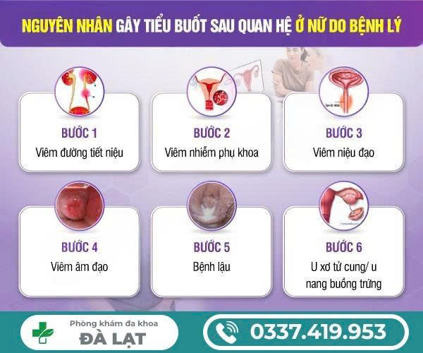 Hình ảnh minh họa